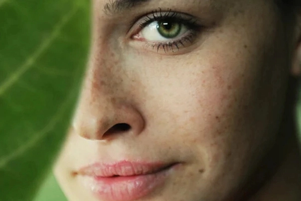 راه های درمان کک و مک