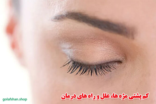 کم-پشتی-مژه-ها،-علل-و-راه-های-درمان