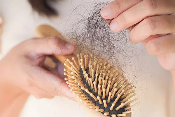 علت ریزش مو