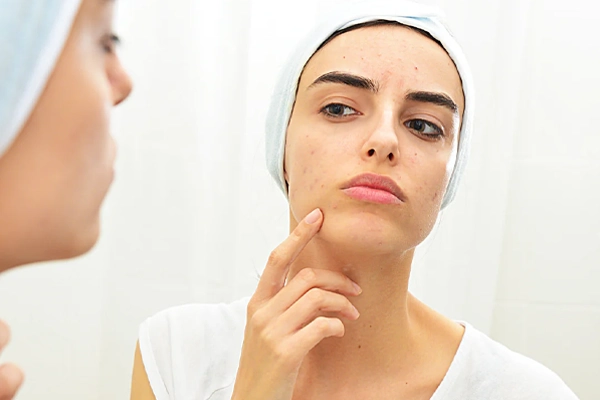 علت بروز جوشهای زیر پوستی